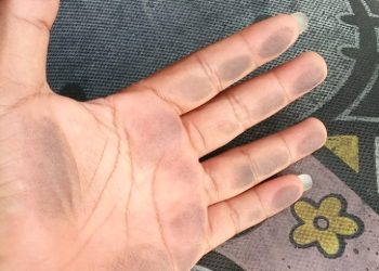 Resiko Bila Terus Menerus Menghirup Udara yang Tercemar Debu Batu Bara