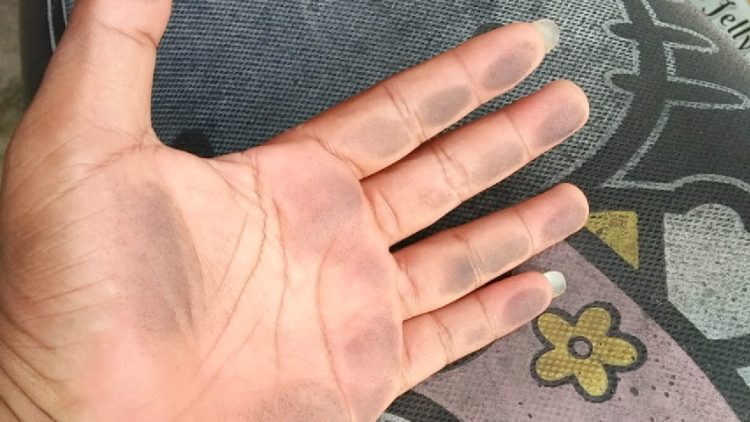 Resiko Bila Terus Menerus Menghirup Udara yang Tercemar Debu Batu Bara